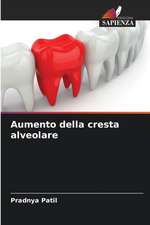 Aumento della cresta alveolare