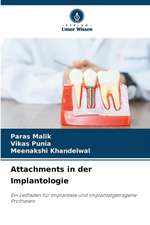 Attachments in der Implantologie