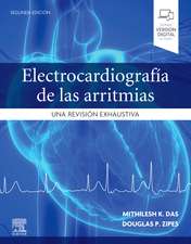 Electrocardiografía de las arritmias: Una revisión exhaustiva