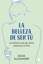 La Belleza de Ser Tú La Historia Real de Cómo Sobreviví Al Tca / The Beauty of Being You: The True Story of How I Overcame an Eating Disorder