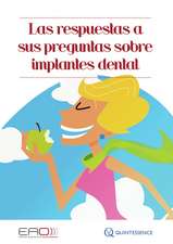 Las respuestas a sus preguntas sobre implantes dental