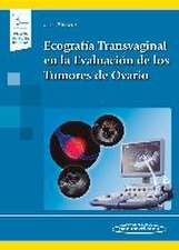 Ecografía transvaginal en la evaluación de los tumores de ovario