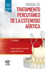 Manual de tratamiento percutáneo de la estenosis aórtica