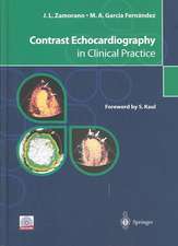 Contrast Echocardiography in Clinical Practice