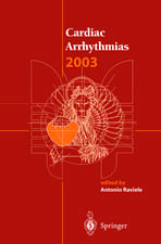 Cardiac Arrhythmias 2003: Proceedings of the 8th International Workshop on Cardiac Arrhythmias