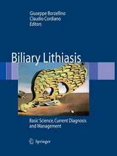 Biliary Lithiasis: Basic Science, Current Diagnosis and Management