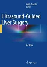 Ultrasound-Guided Liver Surgery: An Atlas