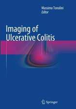 Imaging of Ulcerative Colitis