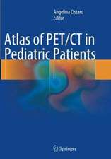 Atlas of PET/CT in Pediatric Patients