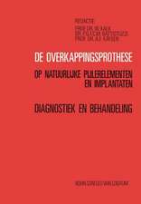 de Overkappingsprothese