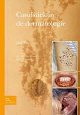 Casuïstiek in de dermatologie - deel 2