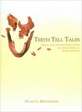 Teeth Tell Tales