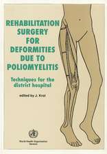 Rehabilitation Surgery for Deformities Due to Poliomyelitis: Techniques for the District Hospital