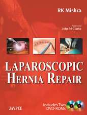 Laparoscopic Hernia Repair