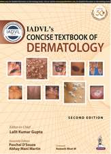 IADVL's Concise Textbook of Dermatology