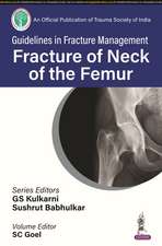 Guidelines in Fracture Management