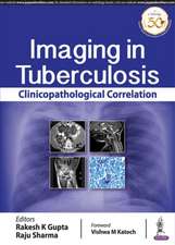 Imaging in Tuberculosis: Clinicopathological Correlation