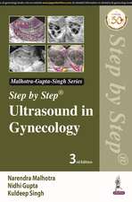 Step by Step Ultrasound in Gynecology