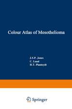 Colour Atlas of Mesothelioma: Prepared for the Commission of the European Communities, Directorate-General Employment, Social Affairs and Education, Industrial Medicine and Hygiene Division