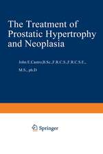 The Treatment of Prostatic Hypertrophy and Neoplasia