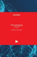 Neuroimaging