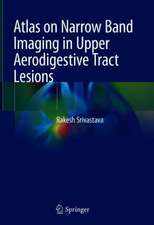 Atlas on Narrow Band Imaging in Upper Aerodigestive Tract Lesions