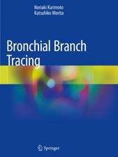 Bronchial Branch Tracing