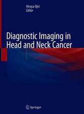 Diagnostic Imaging in Head and Neck Cancer