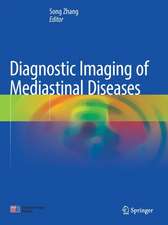 Diagnostic Imaging of Mediastinal Diseases