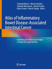 Atlas of Inflammatory Bowel Disease-Associated Intestinal Cancer: Examining the Macroscopic Images of Small and Large Intestine