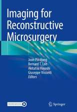 Imaging for Reconstructive Microsurgery