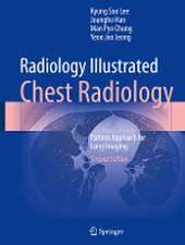 Radiology Illustrated: Chest Radiology: Pattern Approach for Lung Imaging