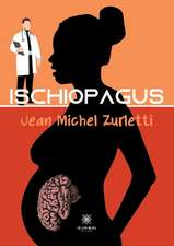 Ischiopagus