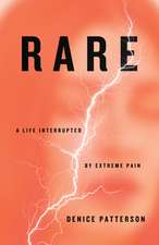 Rare